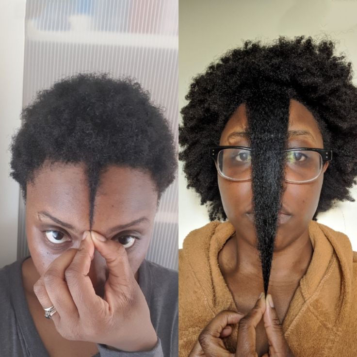 Woman comparing monthly photos of her healthy, natural 4C hair growth.