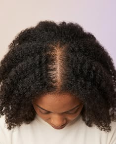 woman with clean scalp
