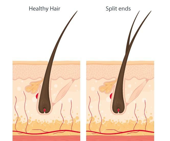illustration comparing healthy hair growing from the scalp versus hair breaking at the ends.