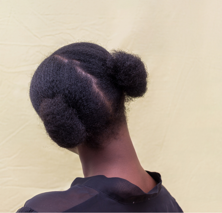 Healthy, clean scalp visible between sections of natural 4C hair.
