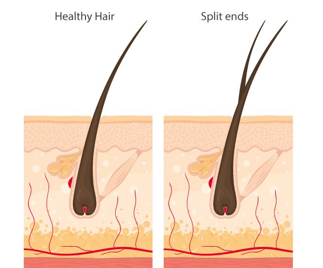 Illustration comparing healthy ends vs split ends