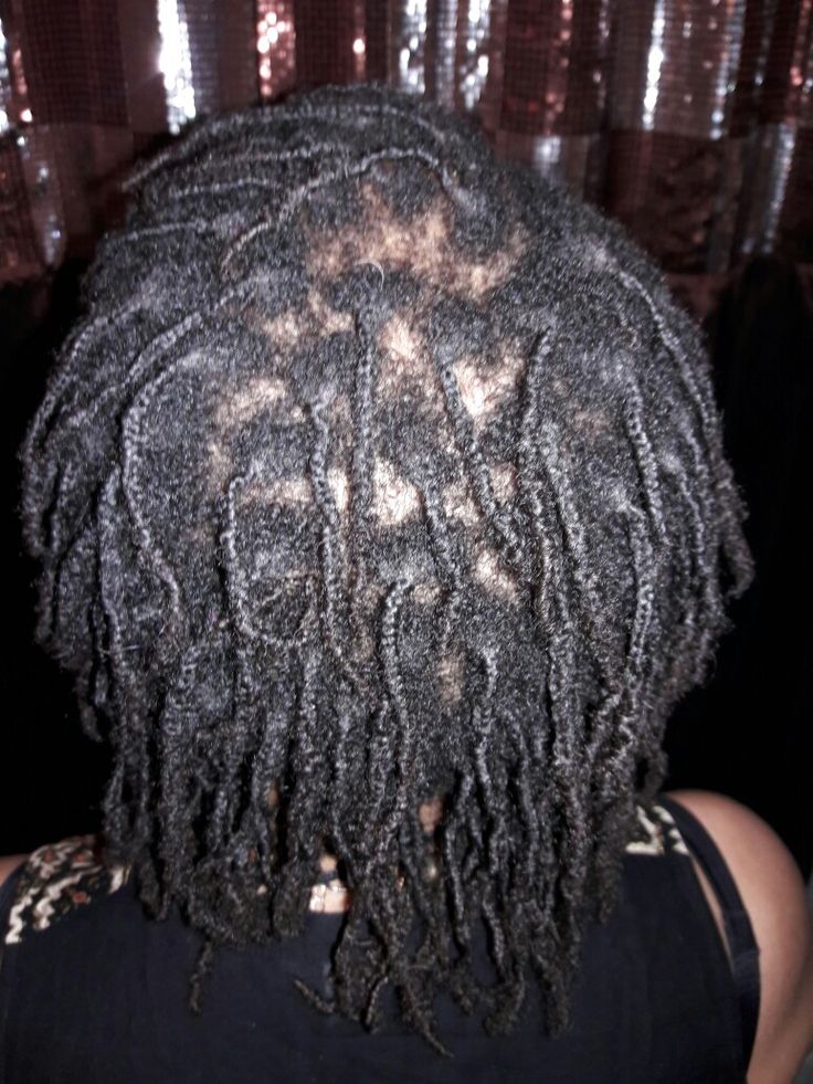 product buildup on starter locs