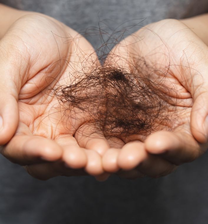 Unusual hair shedding that may require attention