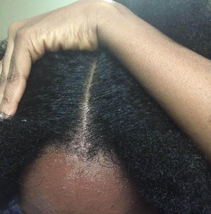 a clean and moisturized scalp