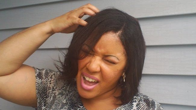 Woman experiencing an itchy scalp