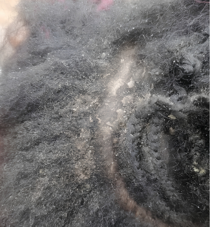 Dandruff and scalp flakes in natural hair