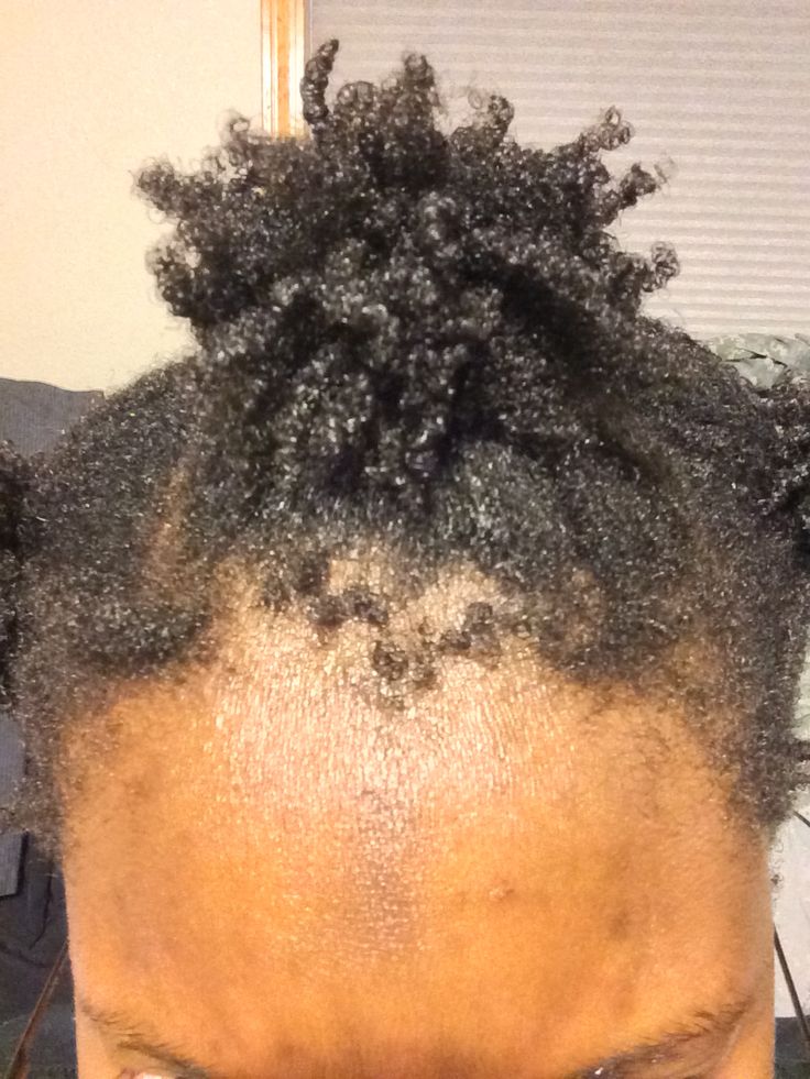 Dry natural edges needing gentle moisture