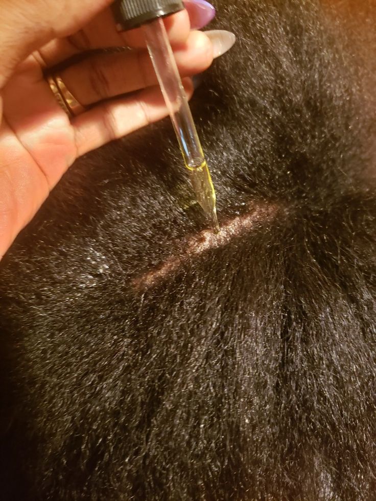 Applying a small amount of oil to a dry scalp