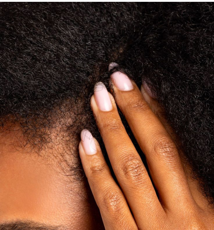 Close-up of a woman gently caring for her scalp.