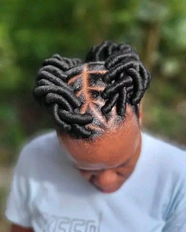 Tight hairstyle creating tension around the hairline
