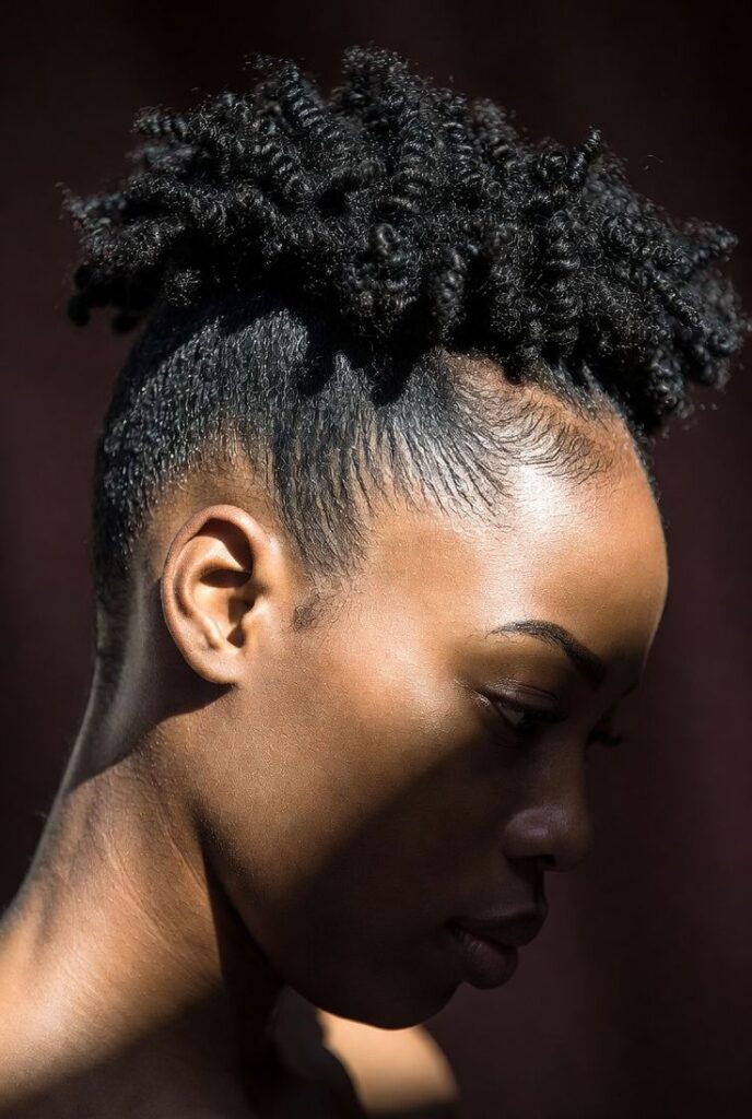 Tight braids creating tension around natural edges