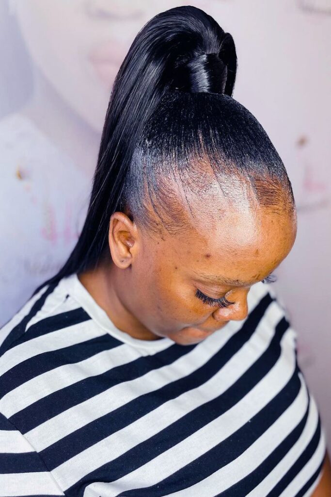 Tight ponytail pulling on the natural hairline