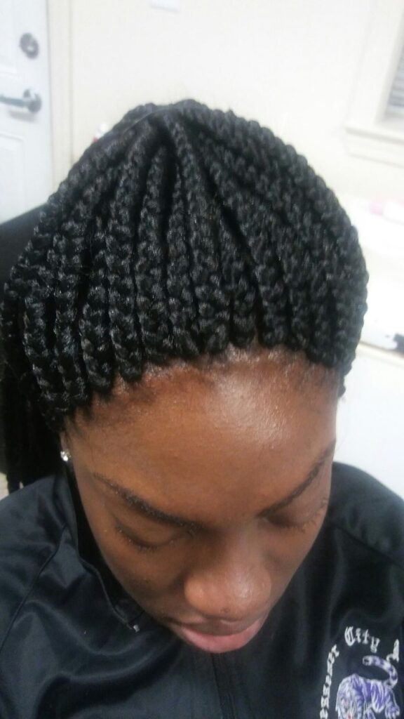 Tight protective hairstyle causing tension on natural hair