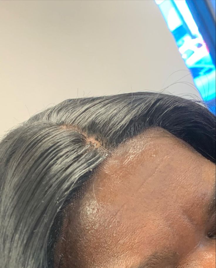 Scalp care under a wig for natural hair
