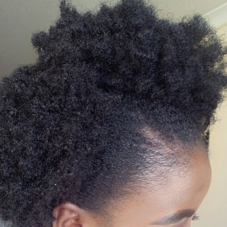 Natural 4C hairline protected from tension and tight styling
