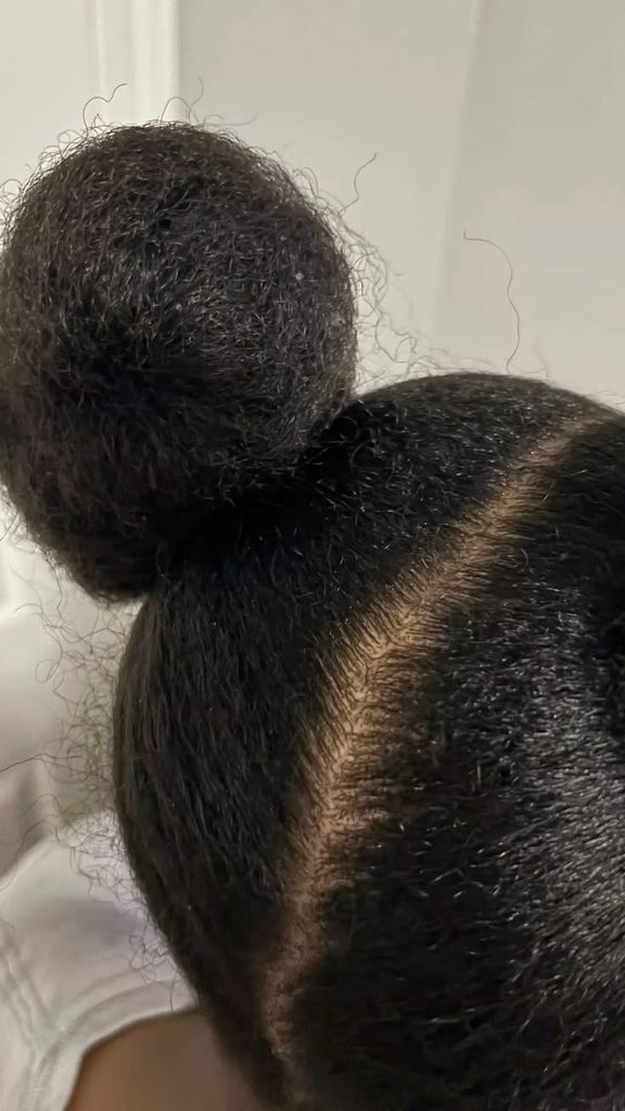 A clean scalp