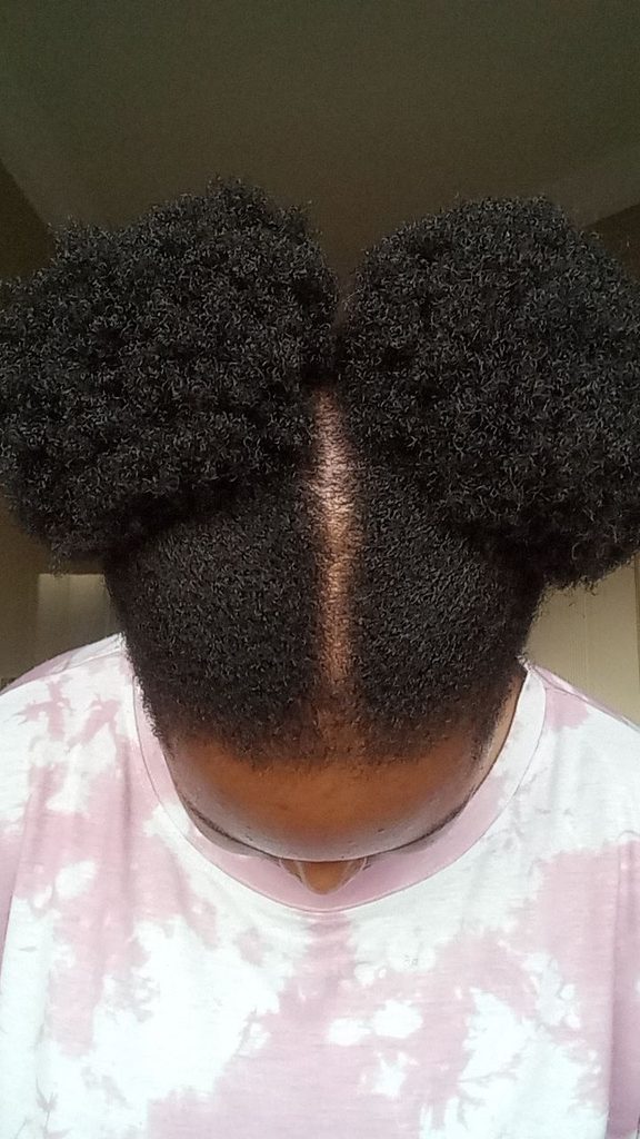Healthy scalp and natural hair before microloc installation