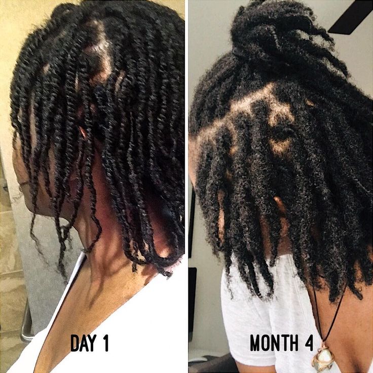 Developing locs showing progress toward maturity