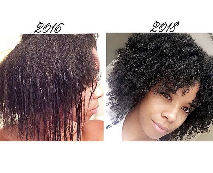  Natural hair growth shown at different stages of a long transition